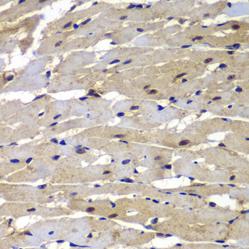 PSMB8 / LMP7 Antibody - Immunohistochemistry of paraffin-embedded rat heart, at a dilution of 1:100.