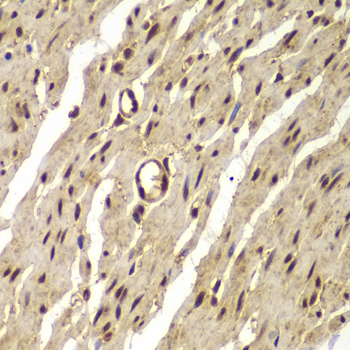 PSMB8 / LMP7 Antibody - Immunohistochemistry of paraffin-embedded human colon tissue, at a dilution of 1:100.