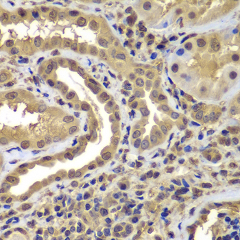 PSMB8 / LMP7 Antibody - Immunohistochemistry of paraffin-embedded human kidney tissue, at a dilution of 1:100.