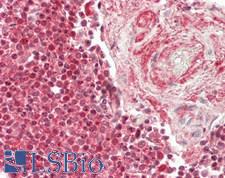 PSMB9 Antibody - Human Spleen: Formalin-Fixed, Paraffin-Embedded (FFPE)