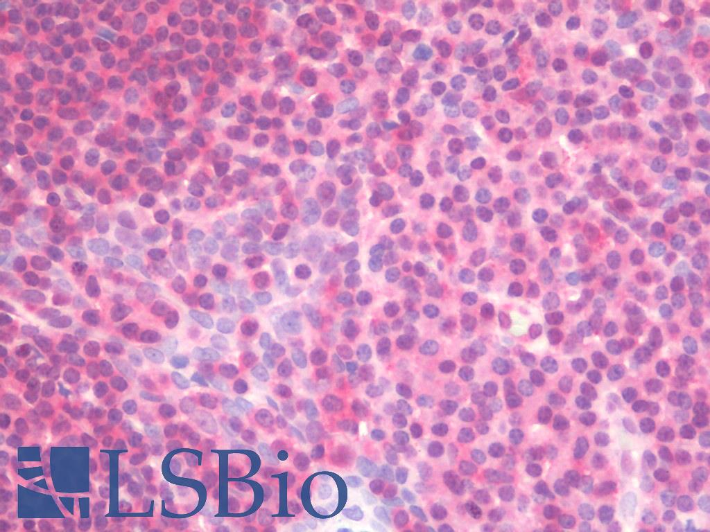 PSMB9 Antibody - Anti-PSMB9 / LMP2 antibody IHC staining of human tonsil. Immunohistochemistry of formalin-fixed, paraffin-embedded tissue after heat-induced antigen retrieval. Antibody concentration 10 ug/ml.