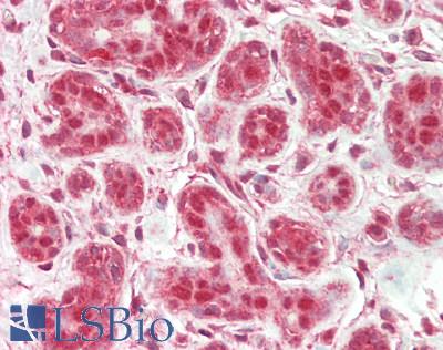PSMC3 Antibody - Human Breast: Formalin-Fixed, Paraffin-Embedded (FFPE)
