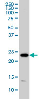 PSMD10 / Gankyrin Antibody - PSMD10 monoclonal antibody (M01), clone 4B5 Western blot of PSMD10 expression in HeLa.
