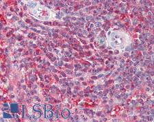 PSME2 Antibody - Anti-PSME2 antibody IHC staining of human spleen. Immunohistochemistry of formalin-fixed, paraffin-embedded tissue after heat-induced antigen retrieval.