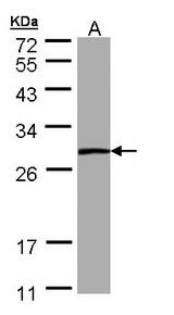PSPH Antibody - Sample (30 ug of whole cell lysate). A: A431. 12% SDS PAGE. PSPH antibody diluted at 1:1000