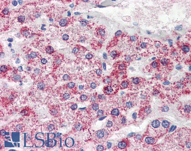 PSPH Antibody - Anti-PSPH antibody IHC of human liver. Immunohistochemistry of formalin-fixed, paraffin-embedded tissue after heat-induced antigen retrieval. Antibody concentration 10 ug/ml.