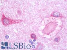 PSPLA1 / Phospholipase A1 Antibody - Anti-PSPLA1 / PLA1A antibody IHC staining of human brain, cortex. Immunohistochemistry of formalin-fixed, paraffin-embedded tissue after heat-induced antigen retrieval. Antibody concentration 10 ug/ml.