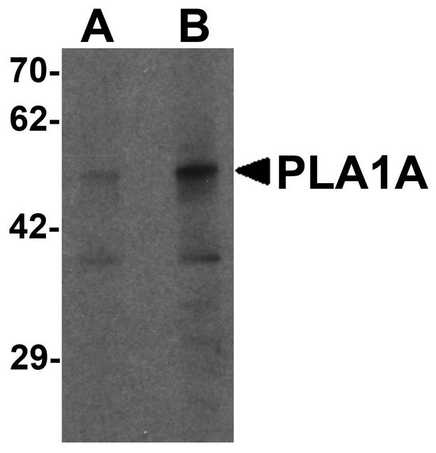 PSPLA1 / Phospholipase A1 Antibody - Western blot analysis of PLA1A in human kidney tissue lysate with PLA1A antibody at (A) 1 and (B) 2 ug/ml.