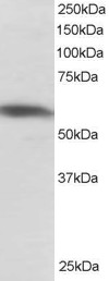 PTBP1 Antibody - Antibody staining (1 ug/ml) of Jurkat lysate (RIPA buffer, 30 ug total protein per lane). Primary incubated for 1 hour. Detected by Western blot of chemiluminescence.