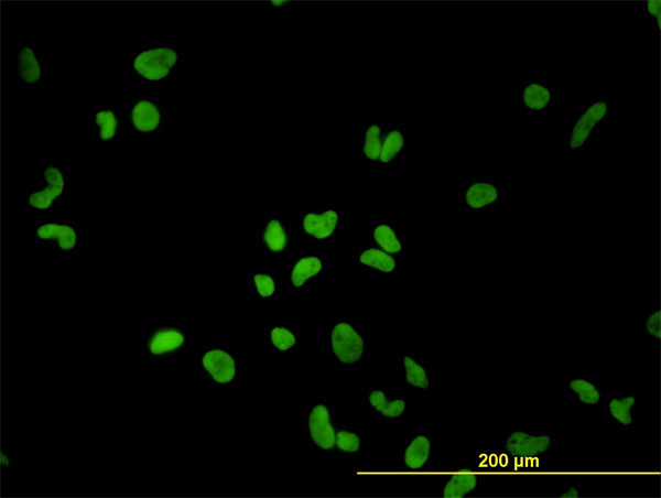 PTBP1 Antibody - Immunofluorescence of monoclonal antibody to PTBP1 on HeLa cell (antibody concentration 10 ug/ml).