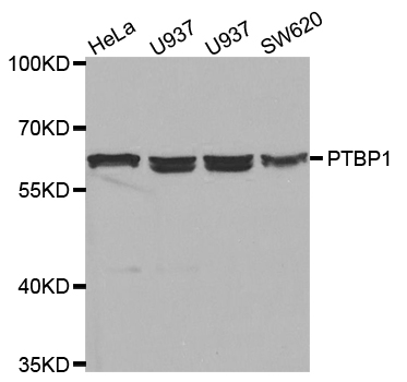PTBP1 Antibody - Western blot analysis of extracts of various cell lines, using PTBP1 antibody.