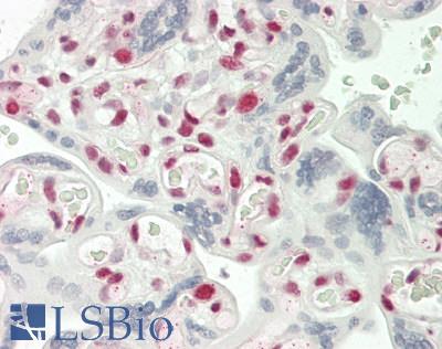 PTBP1 Antibody - Human Placenta: Formalin-Fixed, Paraffin-Embedded (FFPE)