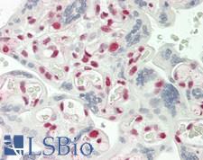 PTBP1 Antibody - Human Placenta: Formalin-Fixed, Paraffin-Embedded (FFPE)