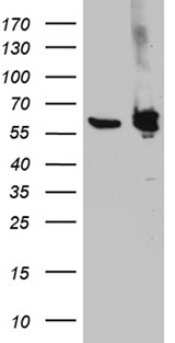 PTBP3 / ROD1 Antibody - HEK293T cells were transfected with the pCMV6-ENTRY control. (Left lane) or pCMV6-ENTRY PTBP3. (Right lane) cDNA for 48 hrs and lysed