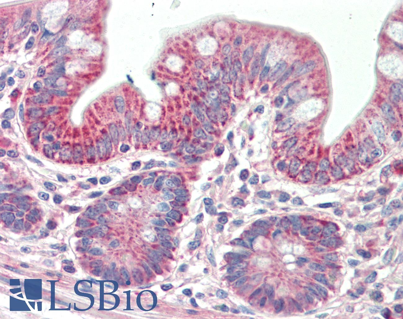 PTCD2 Antibody - Anti-PTCD2 antibody IHC staining of human small intestine. Immunohistochemistry of formalin-fixed, paraffin-embedded tissue after heat-induced antigen retrieval. Antibody concentration 5 ug/ml.