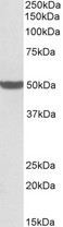 PTCD2 Antibody - PTCD2 antibody (0.5µg/ml) staining of Human Liver lysate (35µg protein in RIPA buffer). Detected by chemiluminescence.