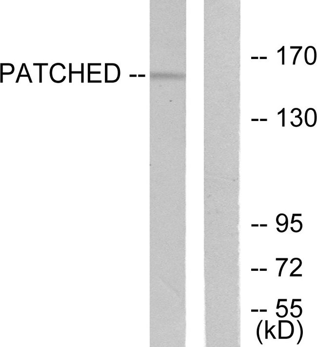 PTCH1 / Patched 1 Antibody - Western blot analysis of lysates from mouse muscle cells, using Patched Antibody. The lane on the right is blocked with the synthesized peptide.