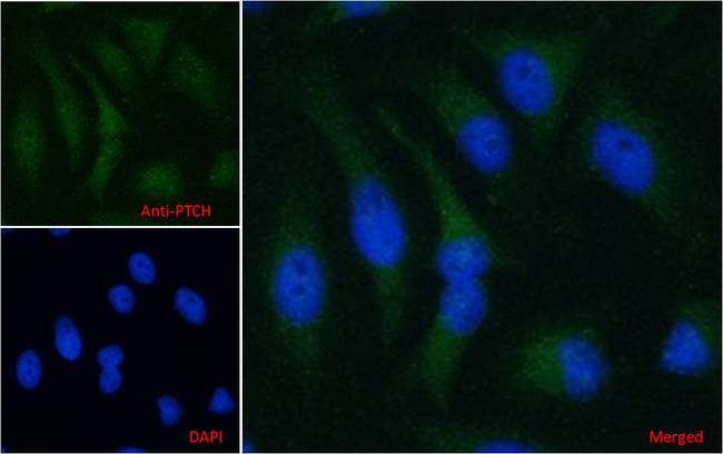 PTCH1 / Patched 1 Antibody - PTCH1 / Patched 1 antibody immunofluorescence analysis of paraformaldehyde fixed HeLa cells, permeabilized with 0.15% Triton. Primary incubation 1hr (5ug/ml) followed by Alexa Fluor 488 secondary antibody (1ug/ml), showing cytoplasmic staining. The nuclear stain is DAPI (blue). Negative control: Unimmunized goat IgG (10ug/ml) followed by Alexa Fluor 488 secondary antibody (2ug/ml).