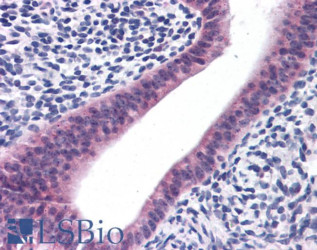 PTCHD2 Antibody - Anti-PTCHD2 antibody IHC of human uterus. Immunohistochemistry of formalin-fixed, paraffin-embedded tissue after heat-induced antigen retrieval. Antibody concentration 5 ug/ml.