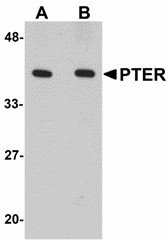 PTER Antibody - Western blot of PTER in human kidney tissue lysate with PTER antibody at (A) 1 and (B) 2 ug/ml.