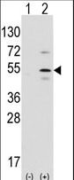 PTF1A Antibody - Western blot of Ptf1a (arrow) using rabbit polyclonal Ptf1a Antibody. 293 cell lysates (2 ug/lane) either nontransfected (Lane 1) or transiently transfected with the Ptf1a gene (Lane 2) (Origene Technologies).