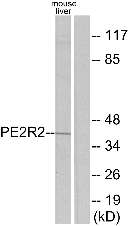 PTGER2 / EP2 Antibody - Western blot analysis of lysates from mouse liver, using PE2R2 Antibody. The lane on the right is blocked with the synthesized peptide.
