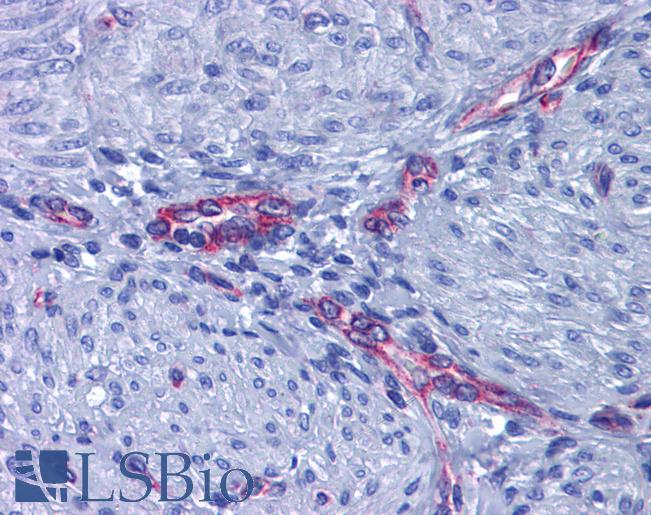 PTGER2 / EP2 Antibody - Anti-EP2 antibody IHC of human uterus, myometrium. Immunohistochemistry of formalin-fixed, paraffin-embedded tissue after heat-induced antigen retrieval. Antibody dilution 1:200.