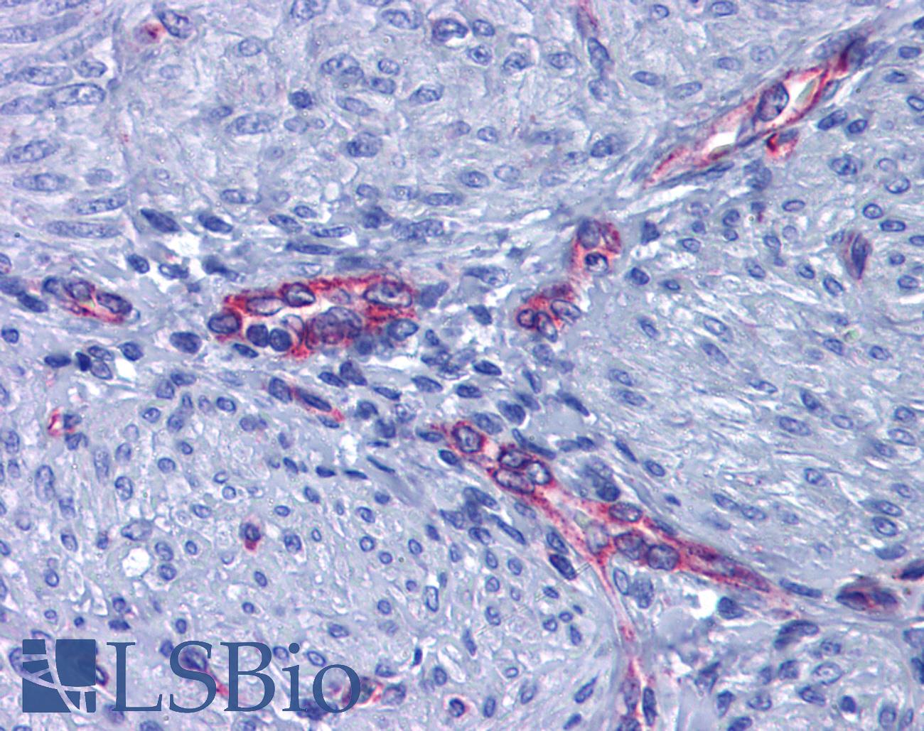 PTGER2 / EP2 Antibody - Anti-EP2 antibody IHC of human uterus, myometrium. Immunohistochemistry of formalin-fixed, paraffin-embedded tissue after heat-induced antigen retrieval. Antibody dilution 1:200.