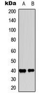 PTGER2 / EP2 Antibody - Western blot analysis of EP2 expression in HeLa (A); mouse kidney (B) whole cell lysates.