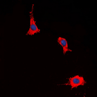 PTGER2 / EP2 Antibody - Immunofluorescent analysis of EP2 staining in HeLa cells. Formalin-fixed cells were permeabilized with 0.1% Triton X-100 in TBS for 5-10 minutes and blocked with 3% BSA-PBS for 30 minutes at room temperature. Cells were probed with the primary antibody in 3% BSA-PBS and incubated overnight at 4 deg C in a humidified chamber. Cells were washed with PBST and incubated with a DyLight 594-conjugated secondary antibody (red) in PBS at room temperature in the dark. DAPI was used to stain the cell nuclei (blue).