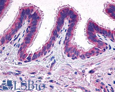 PTGER2 / EP2 Antibody - Anti-EP2 antibody IHC of human lung. Immunohistochemistry of formalin-fixed, paraffin-embedded tissue after heat-induced antigen retrieval.