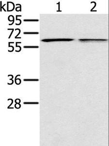 PTGER2 / EP2 Antibody - Western blot analysis of Mouse liver and lung tissue, using PTGER2 Polyclonal Antibody at dilution of 1:200.