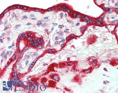 PTGER2 / EP2 Antibody - Human Placenta: Formalin-Fixed, Paraffin-Embedded (FFPE), at a concentration of 5 ug/ml.