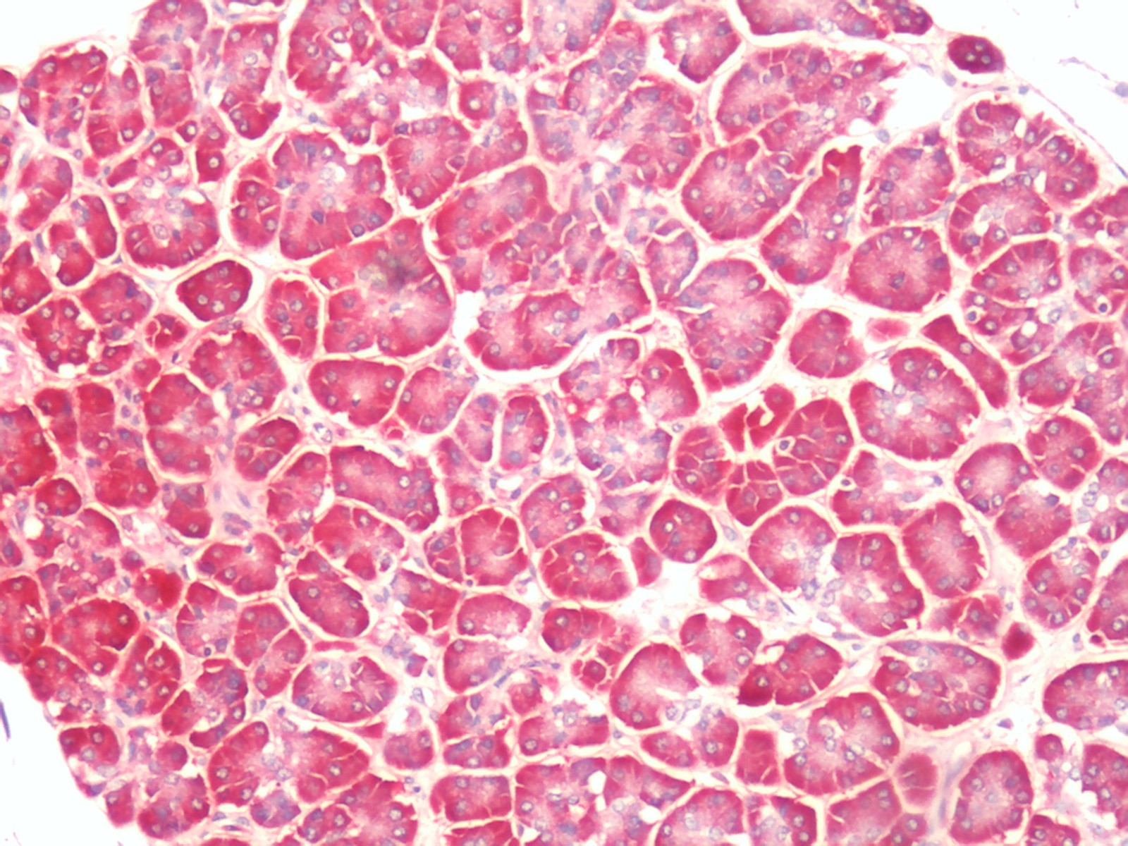 PTGER4 / EP4 Antibody - Human, Pancreas: Formalin-Fixed Paraffin-Embedded (FFPE)