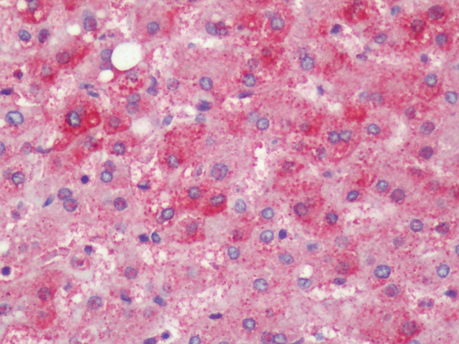 PTGER4 / EP4 Antibody - Human, Liver: Formalin-Fixed Paraffin-Embedded (FFPE)