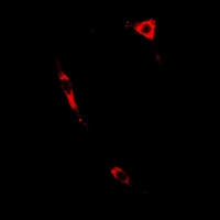 PTGES2 Antibody - Immunofluorescent analysis of PTGES2 staining in A549 cells. Formalin-fixed cells were permeabilized with 0.1% Triton X-100 in TBS for 5-10 minutes and blocked with 3% BSA-PBS for 30 minutes at room temperature. Cells were probed with the primary antibody in 3% BSA-PBS and incubated overnight at 4 deg C in a humidified chamber. Cells were washed with PBST and incubated with a DyLight 594-conjugated secondary antibody (red) in PBS at room temperature in the dark.
