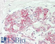 PTGES2 Antibody - Human Breast: Formalin-Fixed, Paraffin-Embedded (FFPE)