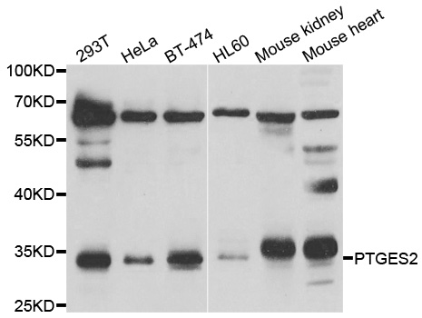 PTGES2 Antibody - Western blot analysis of extracts of various cell lines.