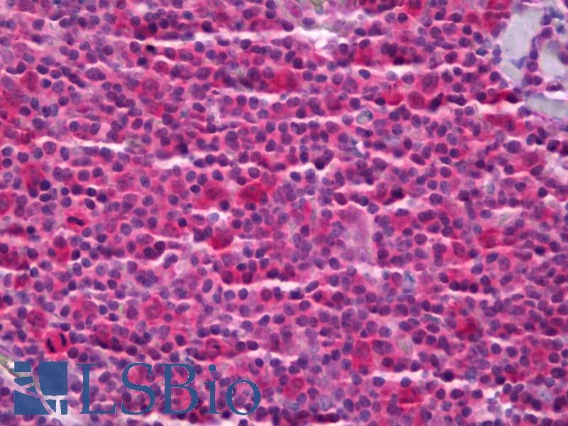 PTGES3 / p23 Antibody - Anti-PTGES3 antibody IHC of human tonsil. Immunohistochemistry of formalin-fixed, paraffin-embedded tissue after heat-induced antigen retrieval. Antibody concentration 5 ug/ml.