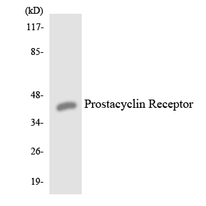 PTGIR / IP Receptor Antibody - Western blot analysis of the lysates from HUVECcells using Prostacyclin Receptor antibody.