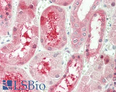 PTGR1 / LTB4DH Antibody - Human Kidney: Formalin-Fixed, Paraffin-Embedded (FFPE)
