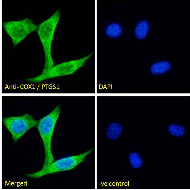 PTGS1 / COX-1 Antibody - PTGS1 / COX1 antibody immunofluorescence analysis of paraformaldehyde fixed NIH3T3 cells, permeabilized with 0.15% Triton. Primary incubation 1hr (5ug/ml) followed by Alexa Fluor 488 secondary antibody (2ug/ml), showing Golgi and vesicle staining. The nuclear stain is DAPI (blue). Negative control: Unimmunized goat IgG (10ug/ml) followed by Alexa Fluor 488 secondary antibody (2ug/ml).