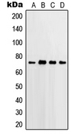 PTGS2 / COX2 / COX-2 Antibody - Western blot analysis of PGHS-2 expression in HeLa (A); Jurkat (B); Raw264.7 (C); rat lung (D) whole cell lysates.