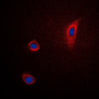 PTGS2 / COX2 / COX-2 Antibody - Immunofluorescent analysis of PGHS-2 staining in Jurkat cells. Formalin-fixed cells were permeabilized with 0.1% Triton X-100 in TBS for 5-10 minutes and blocked with 3% BSA-PBS for 30 minutes at room temperature. Cells were probed with the primary antibody in 3% BSA-PBS and incubated overnight at 4 C in a humidified chamber. Cells were washed with PBST and incubated with a DyLight 594-conjugated secondary antibody (red) in PBS at room temperature in the dark. DAPI was used to stain the cell nuclei (blue).