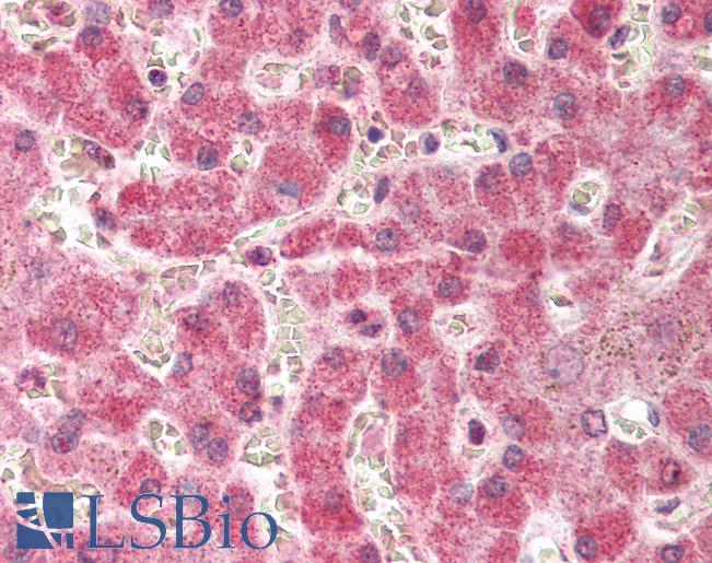 PTGS2 / COX2 / COX-2 Antibody - Anti-COX-2 antibody IHC of human liver. Immunohistochemistry of formalin-fixed, paraffin-embedded tissue after heat-induced antigen retrieval. Antibody dilution 1:500.