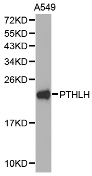 PTHLH / PTHRP Antibody - Western blot analysis of extracts of A549 cell lines, using PTHLH antibody.