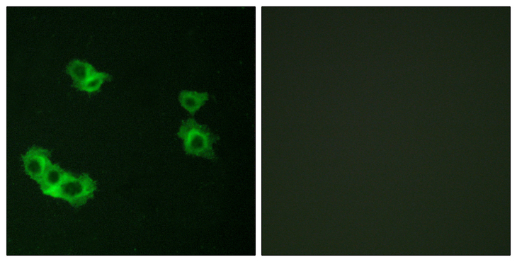 PTHR / PTHR1 Antibody - Immunofluorescence analysis of MCF7 cells, using PTHR1 Antibody. The picture on the right is blocked with the synthesized peptide.