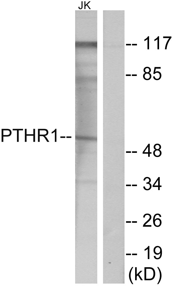 PTHR / PTHR1 Antibody - Western blot analysis of lysates from Jurkat cells, using PTHR1 Antibody. The lane on the right is blocked with the synthesized peptide.