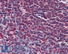 PTP1B Antibody - Human Spleen: Formalin-Fixed, Paraffin-Embedded (FFPE)
