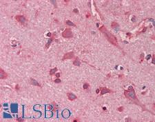PTPN11 / SHP-2 / NS1 Antibody - Human Brain, Cortex: Formalin-Fixed, Paraffin-Embedded (FFPE)